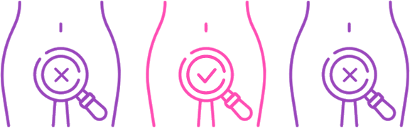 1 in 3 women get fibroids 1 in 3 women get fibroids