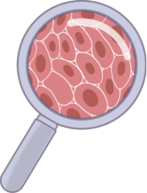 Fibroids Under Magnifying Glass Fibroids Under Magnifying Glass