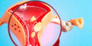 Our treatment is minimally invasive high tech and zero downtime Our treatment is minimally invasive high tech and zero downtime