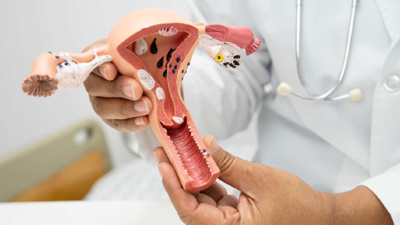 does fibroid removal affect hormones?