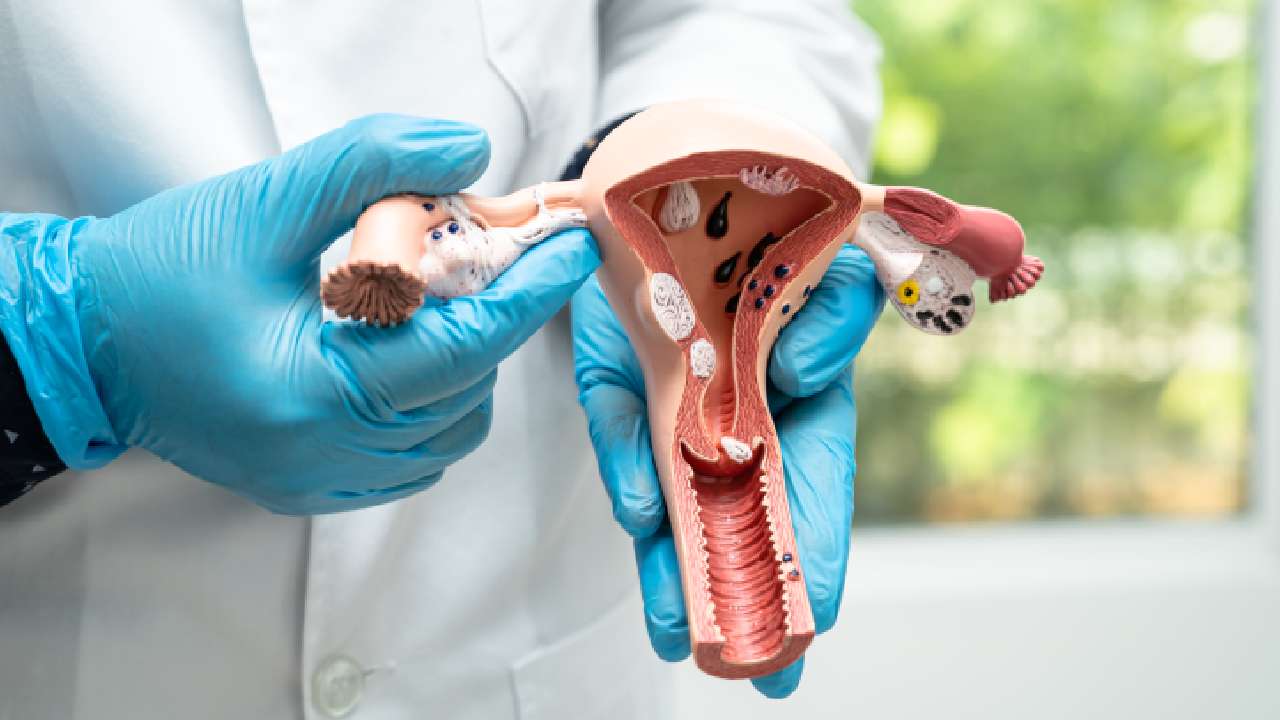 VTC Logo for blog posts does fibroid removal affect hormones?