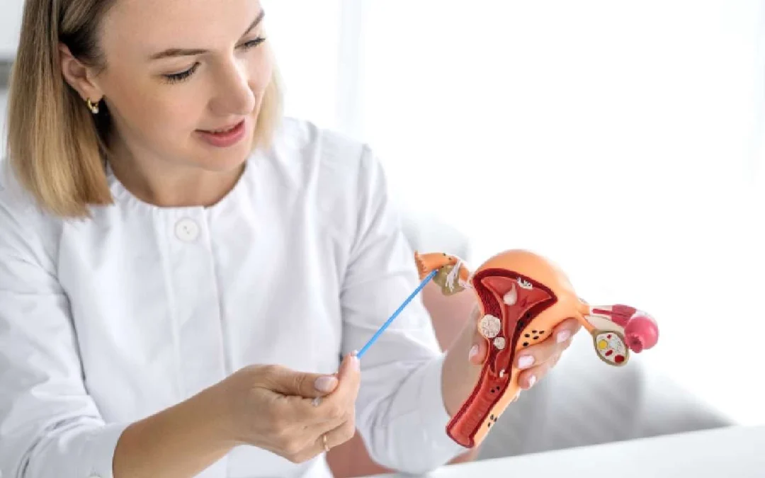 What Causes Fibroids? 5 Things That May Trigger Them in Women