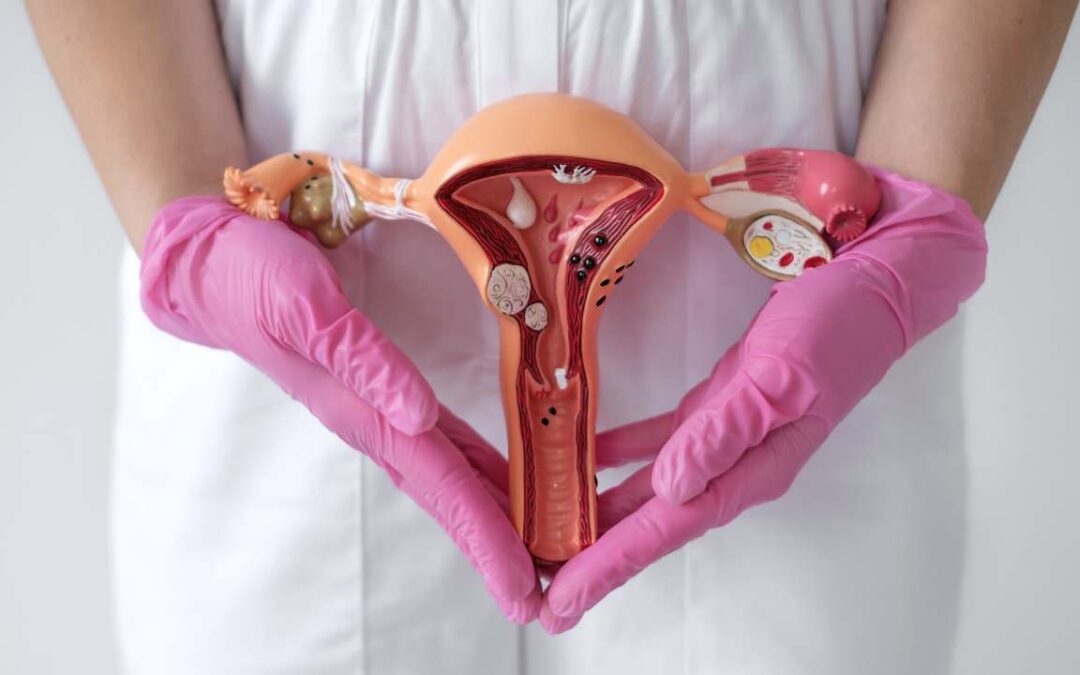 Do Uterine Fibroids Cause Pain? Here’s How to Know If Your Discomfort Is Related