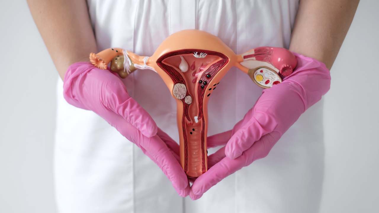 does fibroid removal affect hormones?