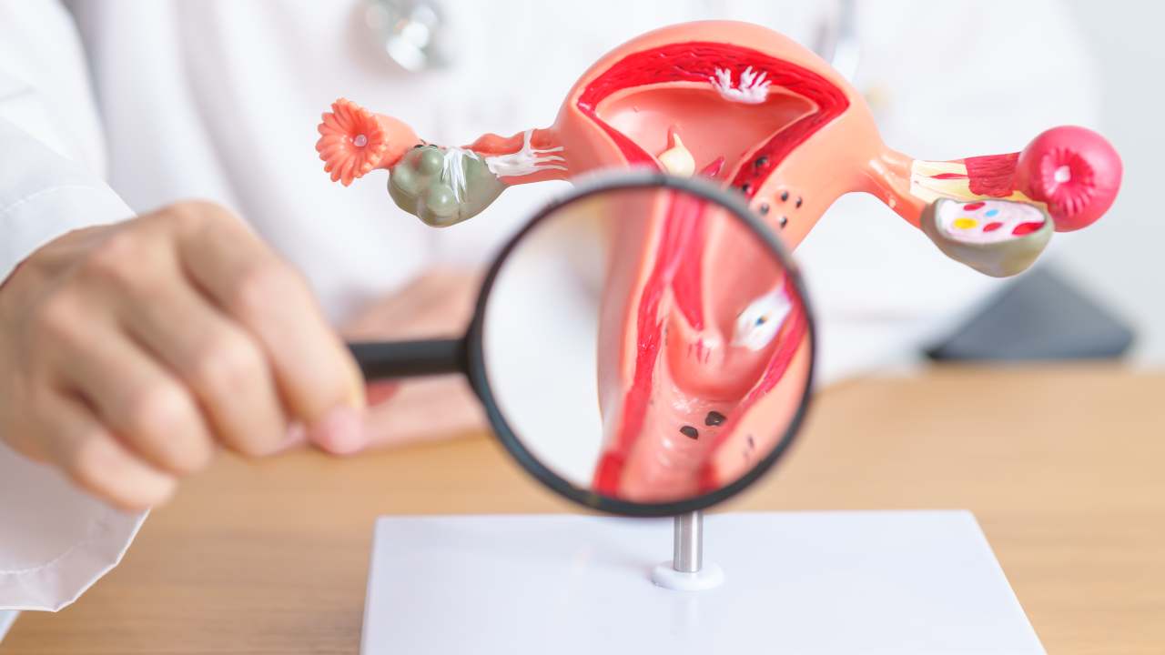 does fibroid removal affect hormones?